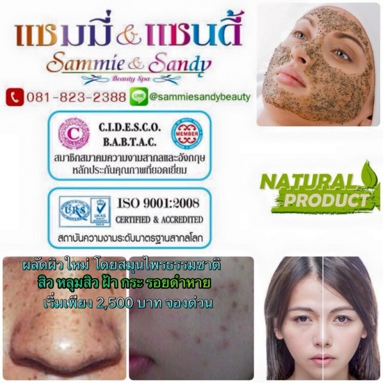 ขจัดสิวหลุมสิว