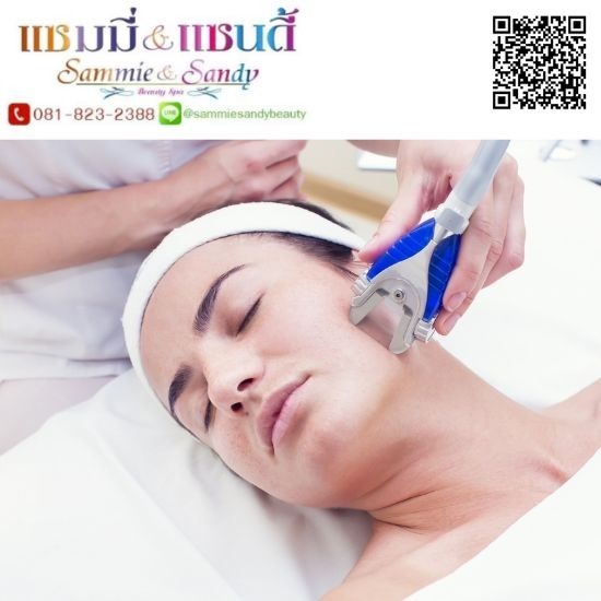 กรอหน้าหลุมสิว กรอหน้าหลุมสิว