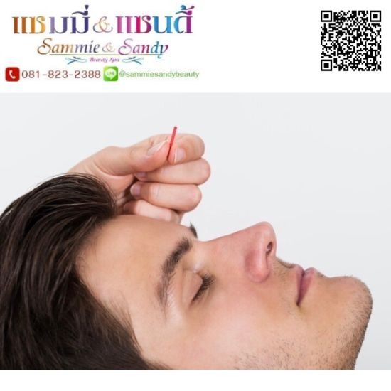 ร้อยไหมคอลลาเจน ร้อยไหมคอลลาเจน